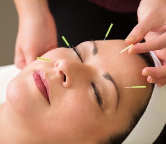 Acupuncture Whatsapp & Telegram Group Link Join List 2022